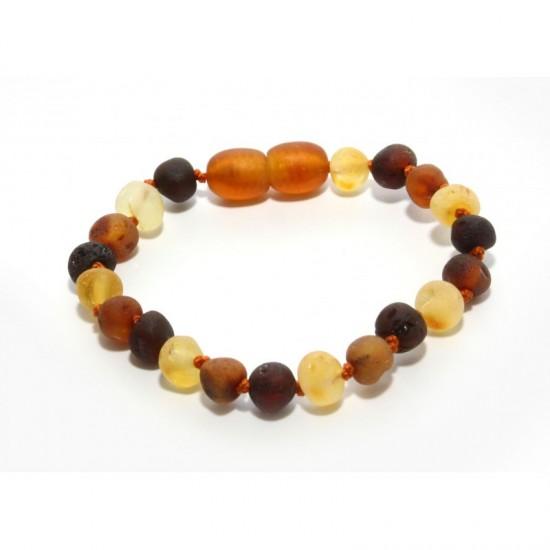 Baltic Amber Anklet / Bracelet