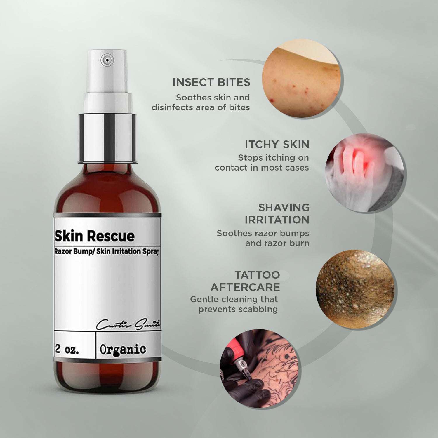 Skin Rescue Spray – Hydrating & Soothing Mist for Skin Repair
